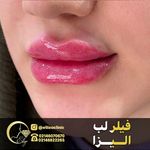 کلینیک تخصصی پوست و مو لیزر‌موهای زائد الیزا