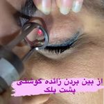 کلینیک تخصصی پوست و مو لیزر‌موهای زائد الیزا