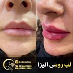 کلینیک تخصصی پوست و مو لیزر‌موهای زائد الیزا