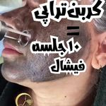 کلینیک تخصصی پوست و مو لیزر‌موهای زائد الیزا