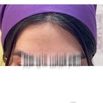 کلینیک تخصصی پوست و مو لیزر‌موهای زائد الیزا