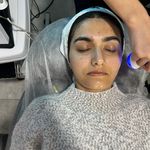 فیشال الا اسکین