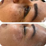 جوانسازی و فیشال پوست خدارحمی