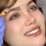 میکروبلیدینگ مریم حمزه ای (مشهد)