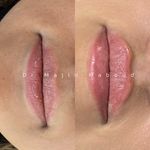 کلینیک زیبایی پوست دکتر مجید قاسمی معبود