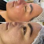 پاکسازی پوست وفیشال تخصصی فاطیما