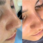 Skincare _eliamini