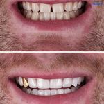 دندانپزشکی پرتو صادقیه از دم قسط با بیمه