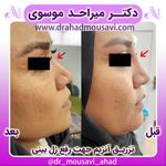 دکترمیراحدموسوی