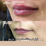 كلينيك زيبايي پوستينو
