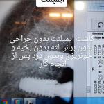 دندانپزشکی ایمپلنت و کلیه خدمات