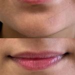 مطب  دکتر ملینا پورکاظمی