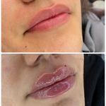 مرکز  پوست مو و زیبایی و لاغری دونادرم