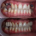 دنداپزشکی دکتر یاشار معزز