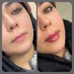 کلینیک لیزر و زیبایی مهرُنا