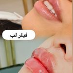 کلینیک لیزر و  زیبایی ملیح