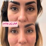 کلینیک لیزر و  زیبایی ملیح