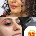 کلینیک لیزر و  زیبایی ملیح