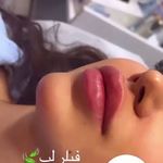کلینیک لیزر و  زیبایی ملیح