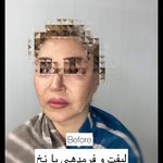 کلینیک لیزر و  زیبایی ملیح
