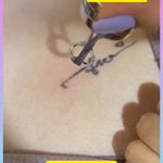 مرکزکلینیک لیزر زیبایی پوست و مو آسا