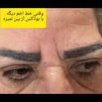 مرکزکلینیک لیزر زیبایی پوست و مو آسا