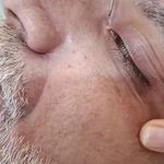 مرکزکلینیک لیزر زیبایی پوست و مو آسا