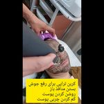 مرکزکلینیک لیزر زیبایی پوست و مو آسا