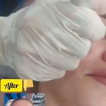 مرکزکلینیک لیزر زیبایی پوست و مو آسا