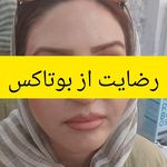 مرکزکلینیک لیزر زیبایی پوست و مو آسا