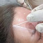 مرکزکلینیک لیزر زیبایی پوست و مو آسا