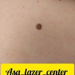 مرکزکلینیک لیزر زیبایی پوست و مو آسا