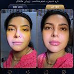 کلینیک تخصصی زیبایی و لیزر موی ابریشم