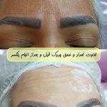 کلینیک زیبایی لاوین شرق