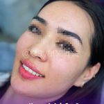 کلینیک لیزر و زیبایی دایان