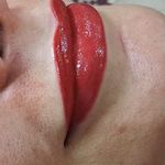 میکروبلدینگ ومیکروپیگمنتیشن حسینی