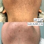 مرکز لیزر وکلینیک زیبایی پایون(بانوان)