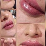 کلینیک زیبایی و لیزر مایا (دکتر وحیدی)