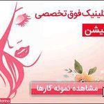 سالن میکرو آرزو