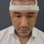 کلینیک تخصصی کاشت موی پرنیان