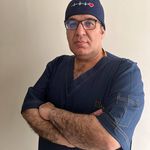 لیزر کیست مویی دکتر بابک ثابت