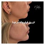 کلینیک زیبایی و لیزر مو زائد نوبا