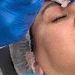 میکروبلیدینگ و میکروپیگمنتیشن مهتا پناهی