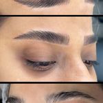 میکروبلیدینگ و میکروپیگمنتیشن مهتا پناهی