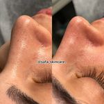 آموزشگاه و مرکز تخصصی پوست و موی قم