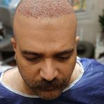 مرکز پوست و لیزر  سایناشور آمریکا دلدار