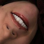کلینیک طراحی لبخند مایا