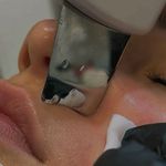 خدمات تخصصی هیدرو فیشال صورت نومه لوکس