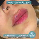 مطب زیبایی دکتر سمر نامیان