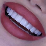 کلینیک دندانپزشکی خاورمیانه نقد و اقساط